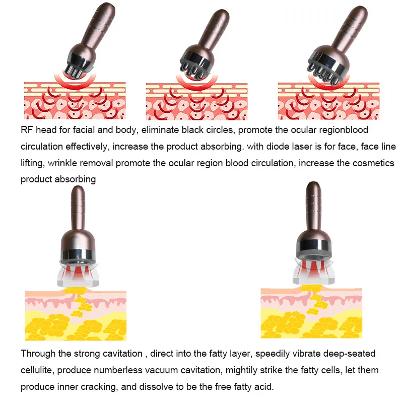 Shape Tactics ProElite 40K RF Lipo Laser System - Renee Lane Company