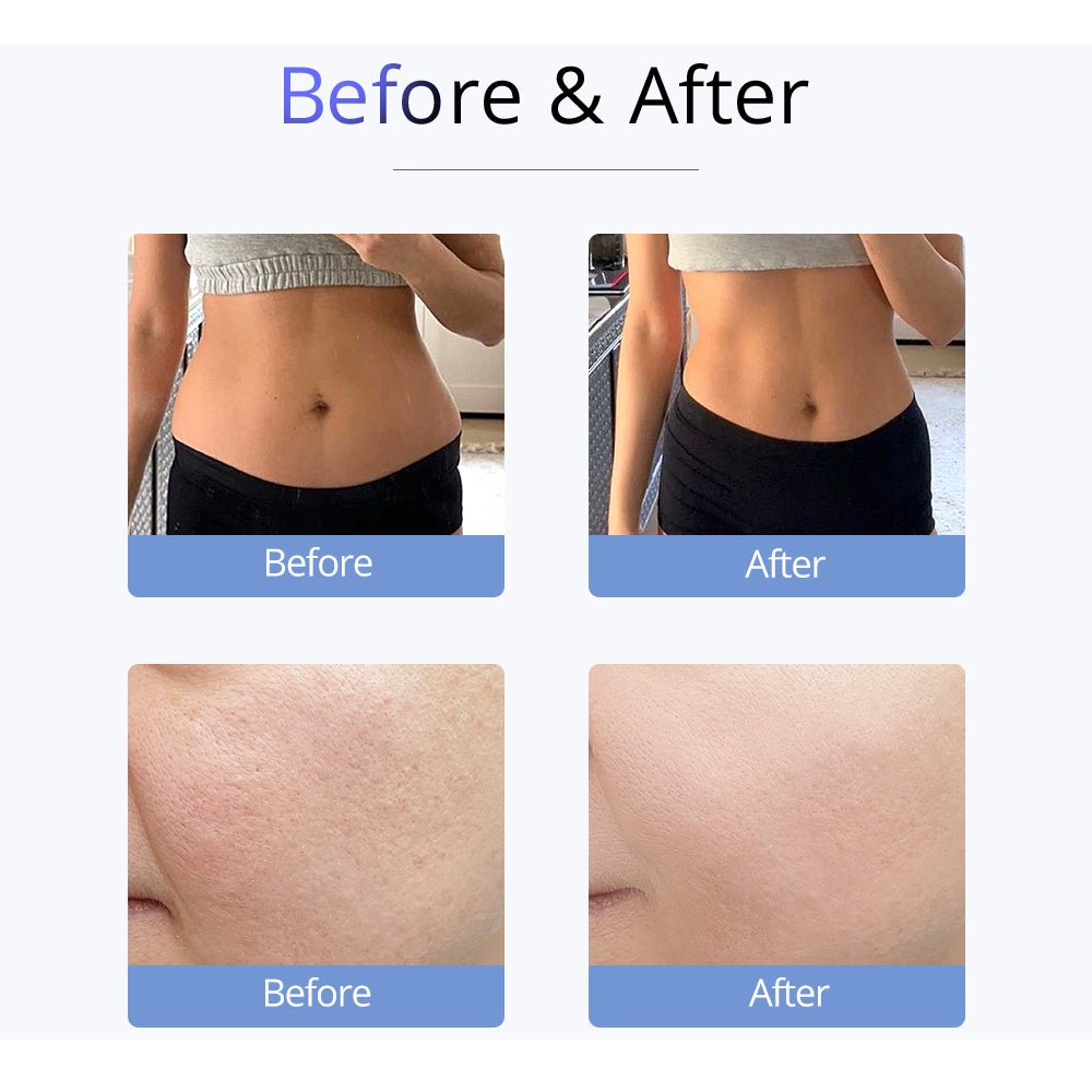 Shape Tactics S-Shape 30K Ultrasonic Cavitation & RF Vacuum Therapy System - Renee Lane Company