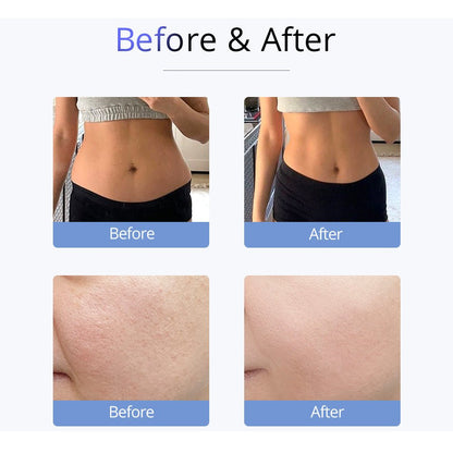 Shape Tactics S-Shape 30K Ultrasonic Cavitation & RF Vacuum Therapy System - Renee Lane Company