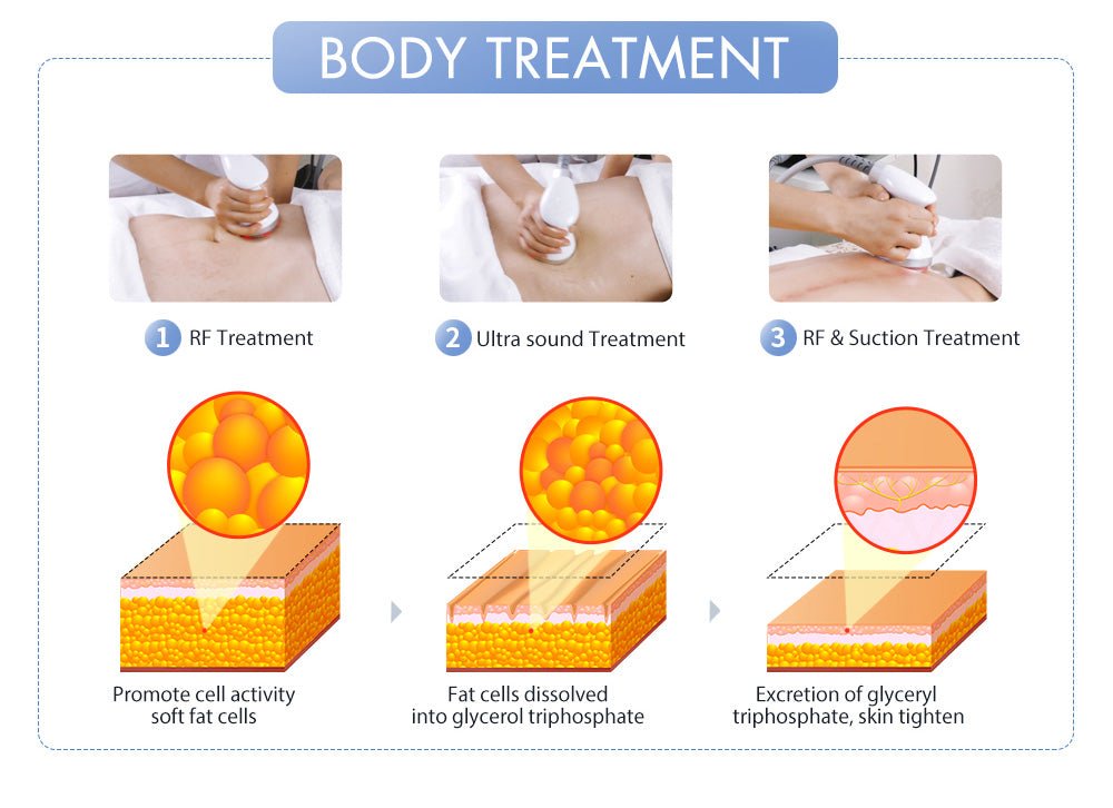 Shape Tactics S-Shape Pro 30K Cavitation RF Contouring System - Renee Lane Company