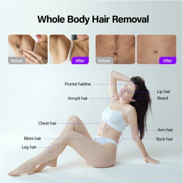 Shape Tactics Soprano Ice Pro 4-in-1 Laser Hair & Skin System - Renee Lane Company