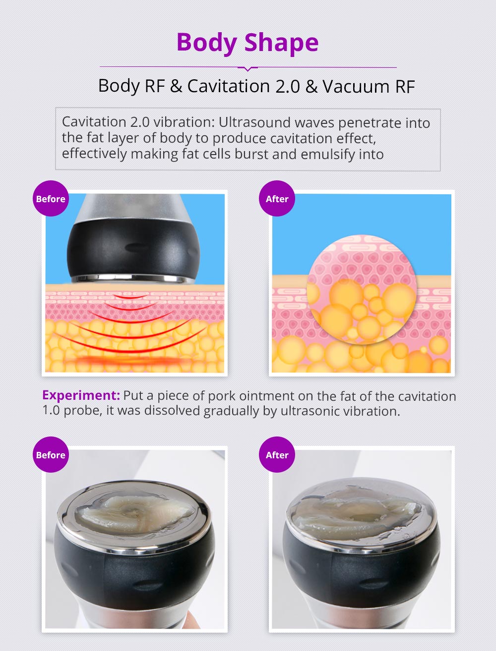 Shape Tactics Unoisetion 40K Cavitation Ultrasound RF Vacuum Photon System - Renee Lane Company