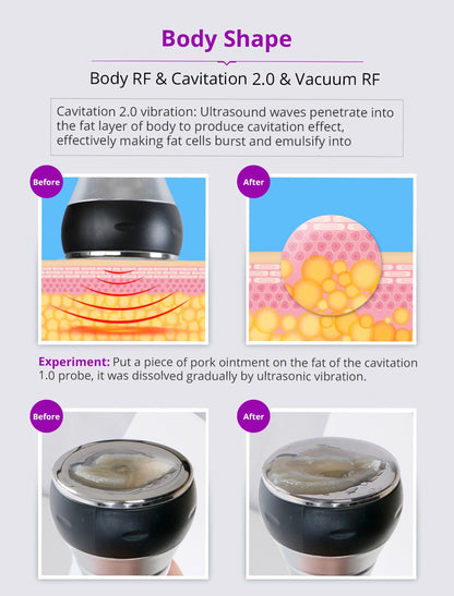 Shape Tactics Unoisetion 40K Cavitation Ultrasound RF Vacuum Photon System - Renee Lane Company
