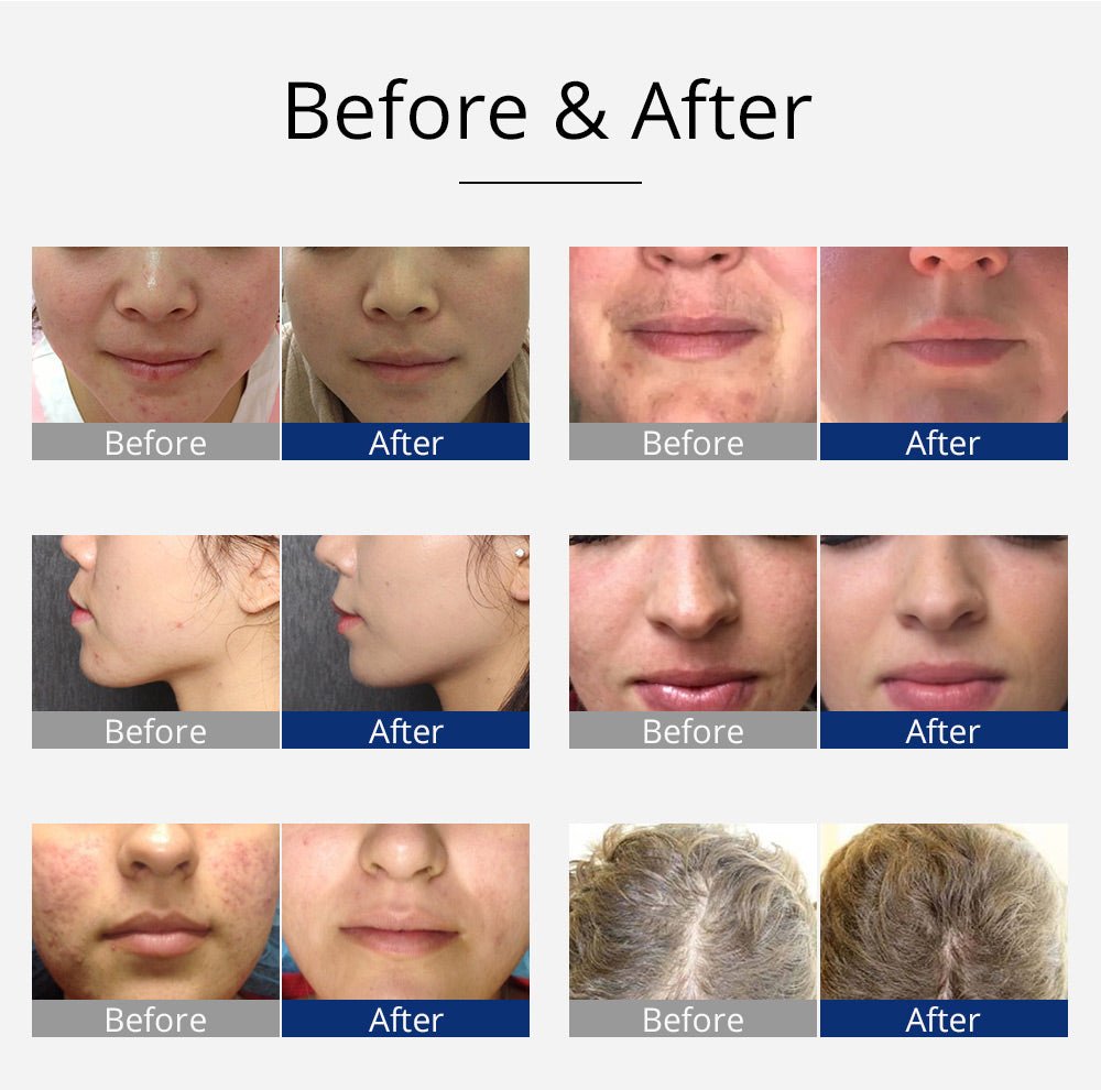 Shape Tactics Violet 7-Electrode High-Frequency Facial System - Renee Lane Company