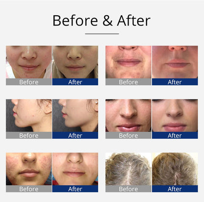 Shape Tactics Violet 7-Electrode High-Frequency Facial System - Renee Lane Company