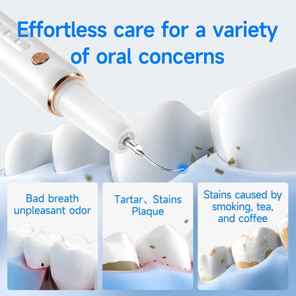 T4 Ultrasonic Tooth Cleaner | Safe & Effective Dental Care - Renee Lane Company