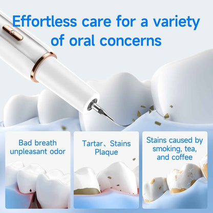 T5 Ultrasonic Tooth Cleaner | Advanced Plaque & Tartar Remover - Renee Lane Company