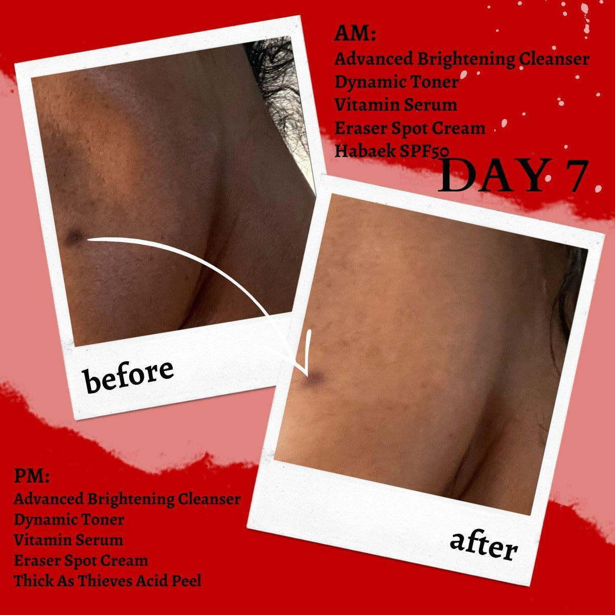 Spot corrector cream bottle in a before-and-after collage for dark spots