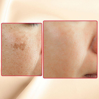 Dark spot corrector cream results on skin close-ups, before and after views