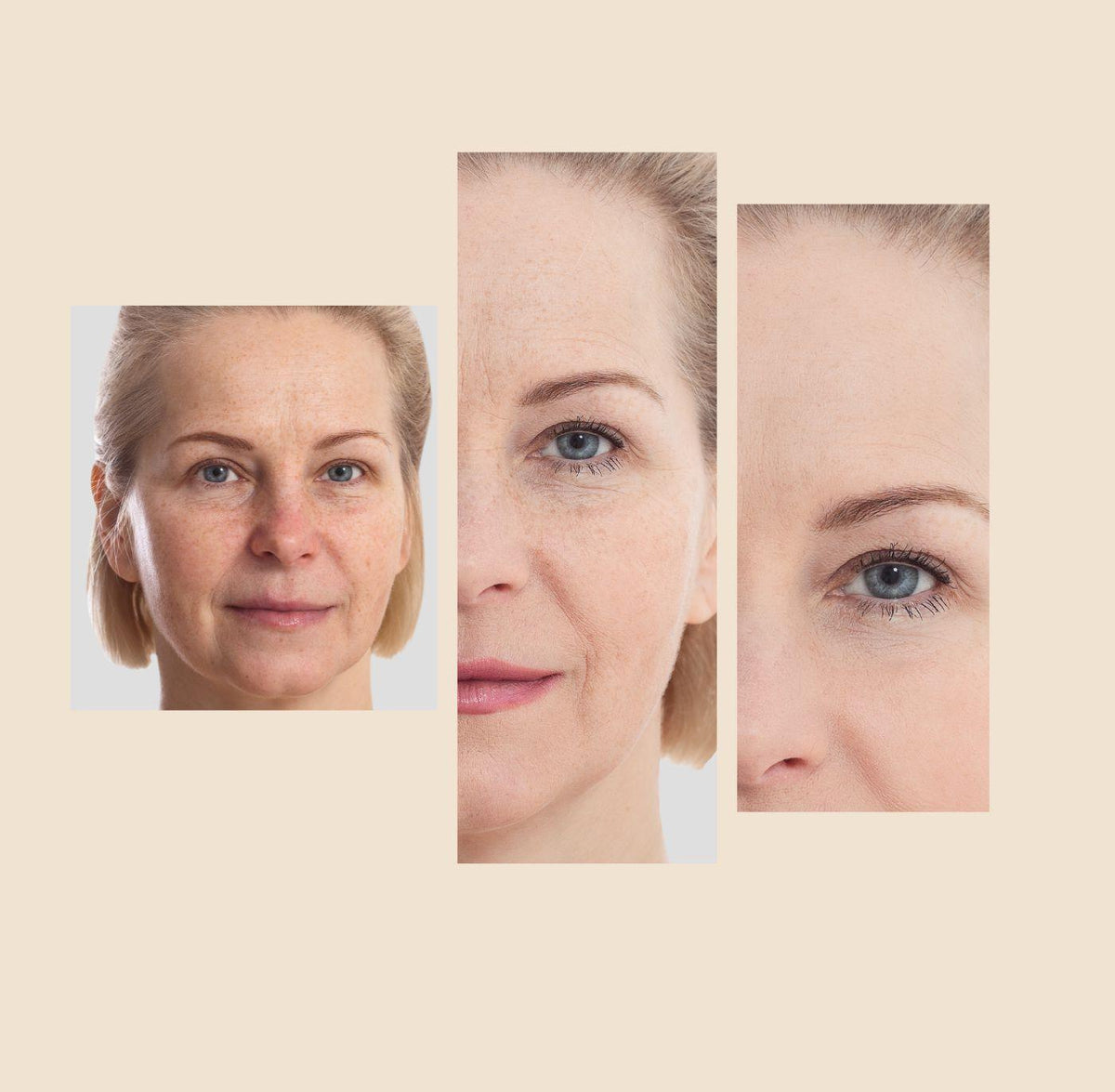 Dark spot corrector cream results on face close-ups, before-and-after style panels