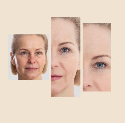 Dark spot corrector cream results on face close-ups, before-and-after style panels