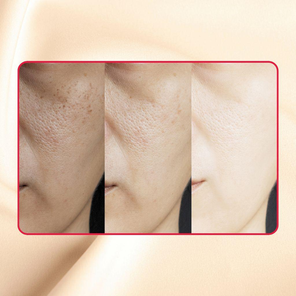 Thick As Thieves Pure Glycolic Acid Lactic Acid Extreme Gel Peel - 30ml - Renee Lane Company
