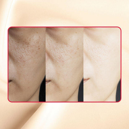Thick As Thieves Pure Glycolic Acid Lactic Acid Extreme Gel Peel - 50ml - Renee Lane Company