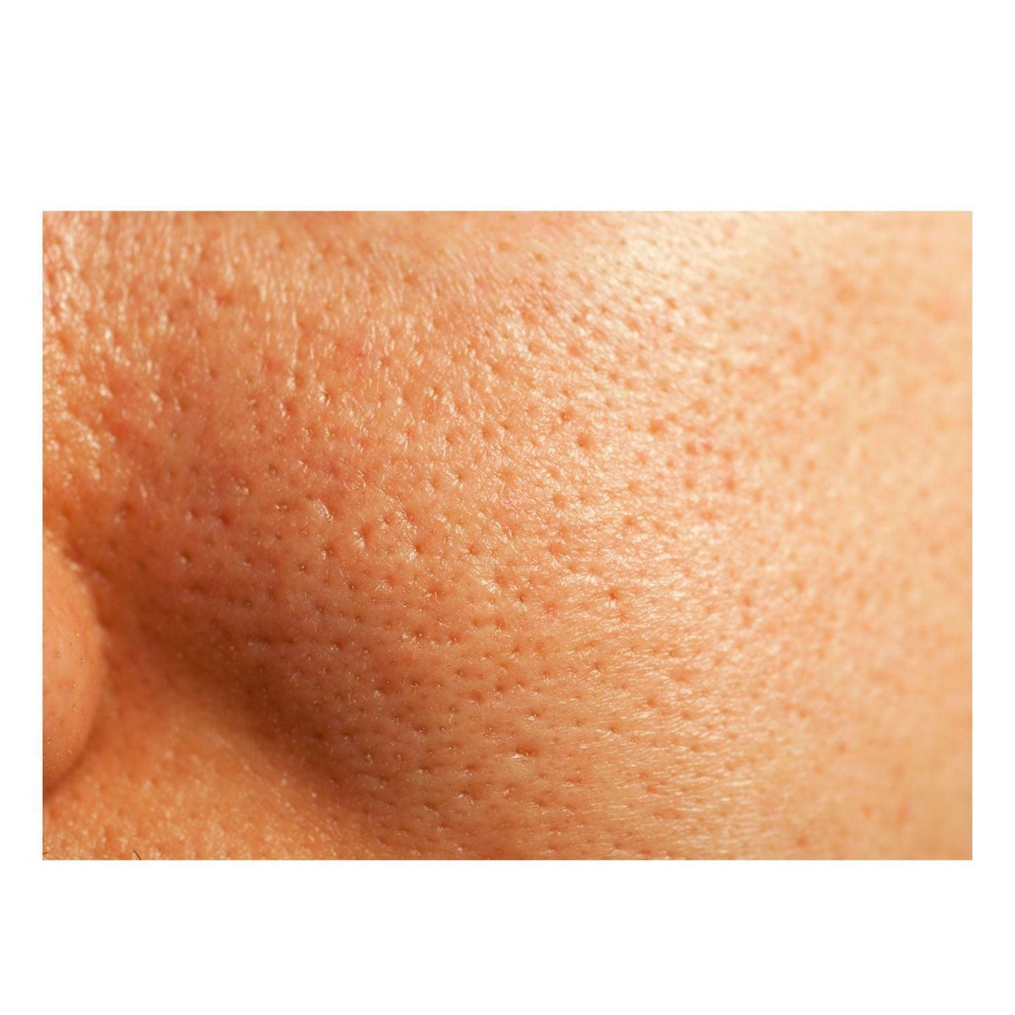 Thick As Thieves Pure Glycolic Acid Lactic Acid Extreme Gel Peel - 50ml - Renee Lane Company