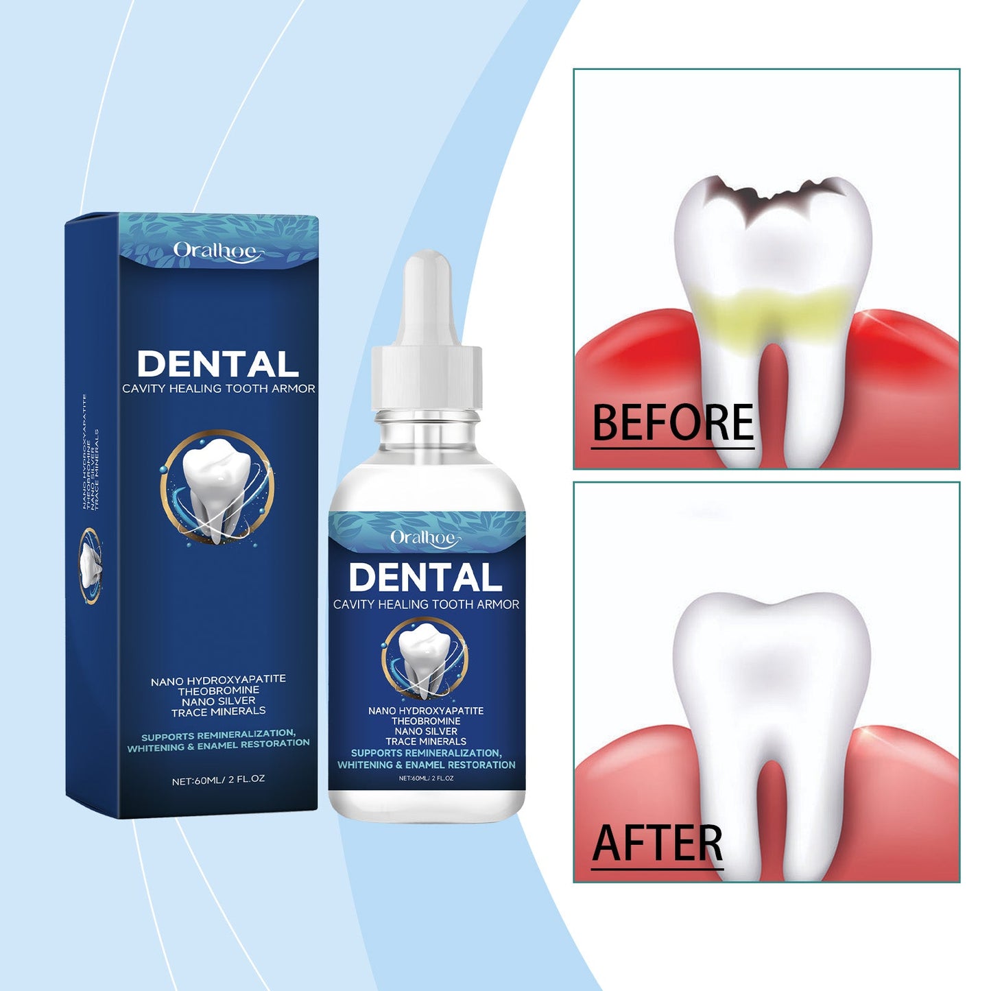 Tooth Care Solution - Renee Lane Company