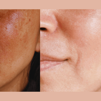Ultra-Advanced Anti-Aging Daily Resurfacing Pads - Renee Lane Company
