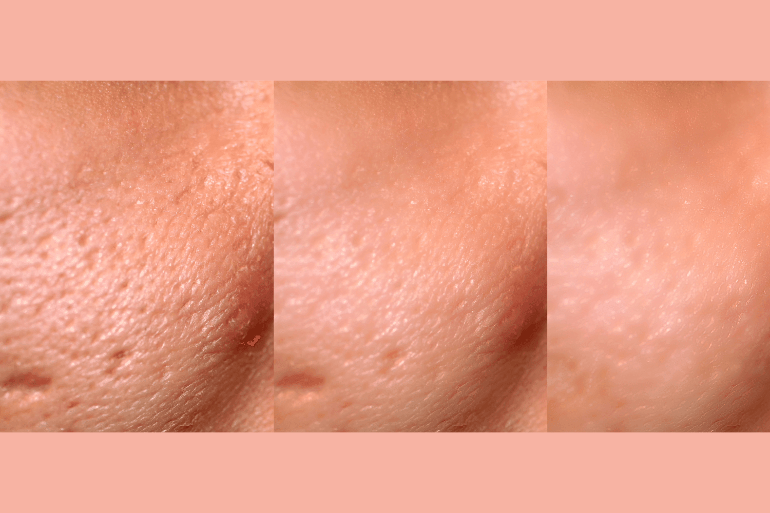 Ultra-Advanced Anti-Aging Daily Resurfacing Pads - Renee Lane Company