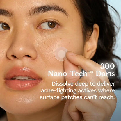 Ultra-Strength Microdart Acne Patch - Renee Lane Company