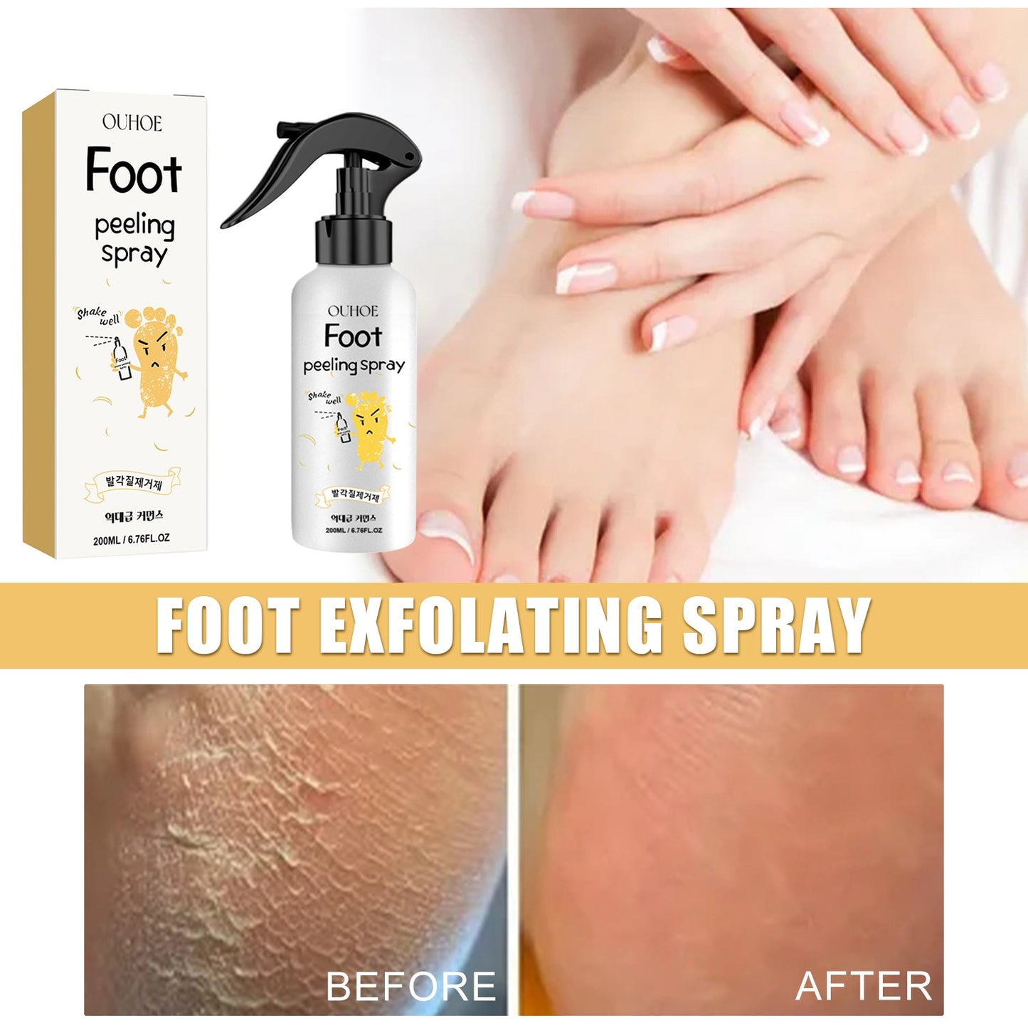 Foot exfoliating spray bottle with trigger nozzle and retail box above skin samples