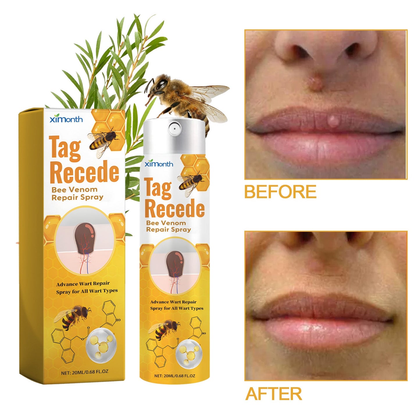 Bee Purifying Skin Spray 20ML box and bottle with before/after lip panels, ximonth