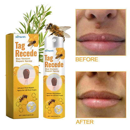 Bee Purifying Skin Spray 20ML box and bottle with before/after lip panels, ximonth