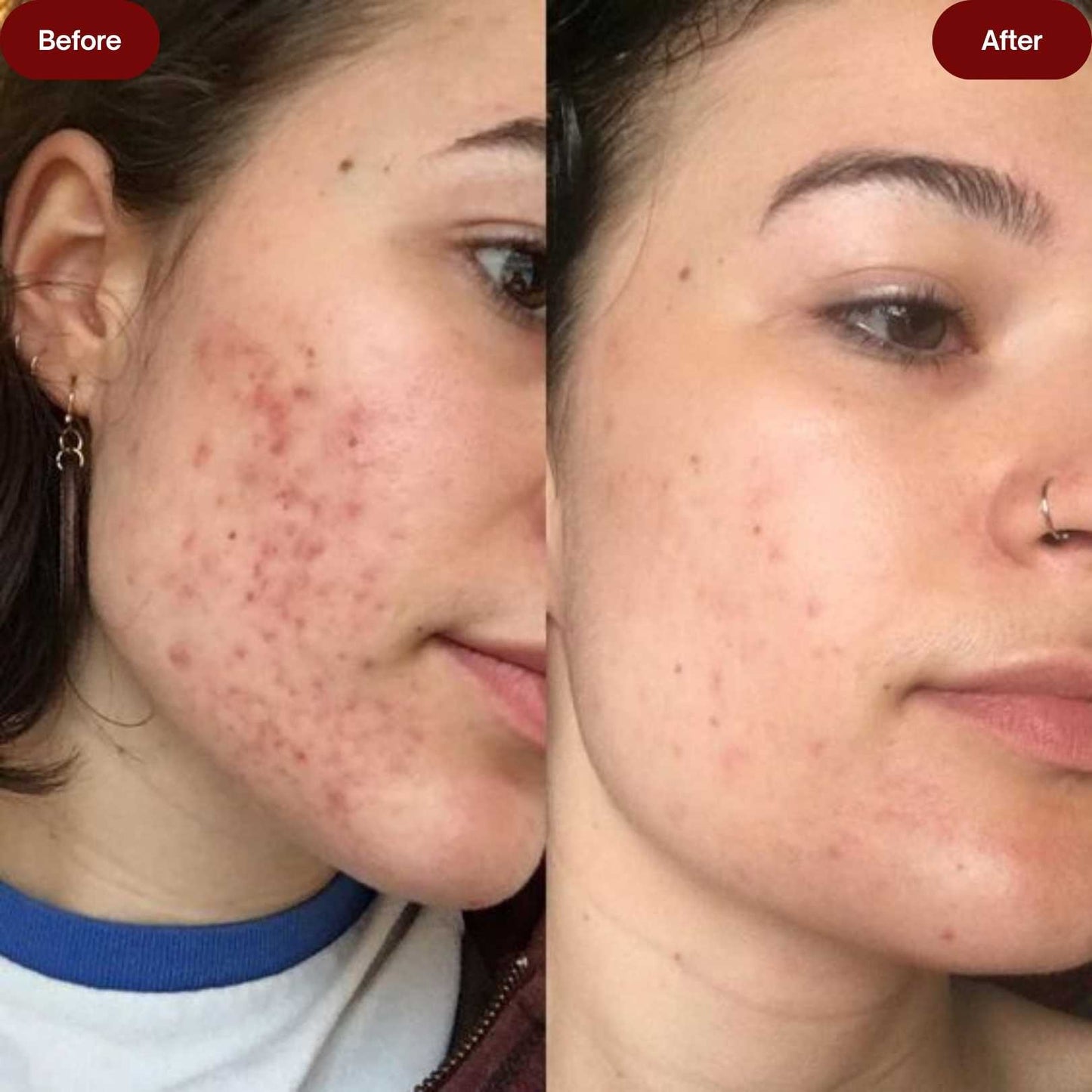 Full Skincare Routine Kit for Flawless Skin by Blisfull Skin