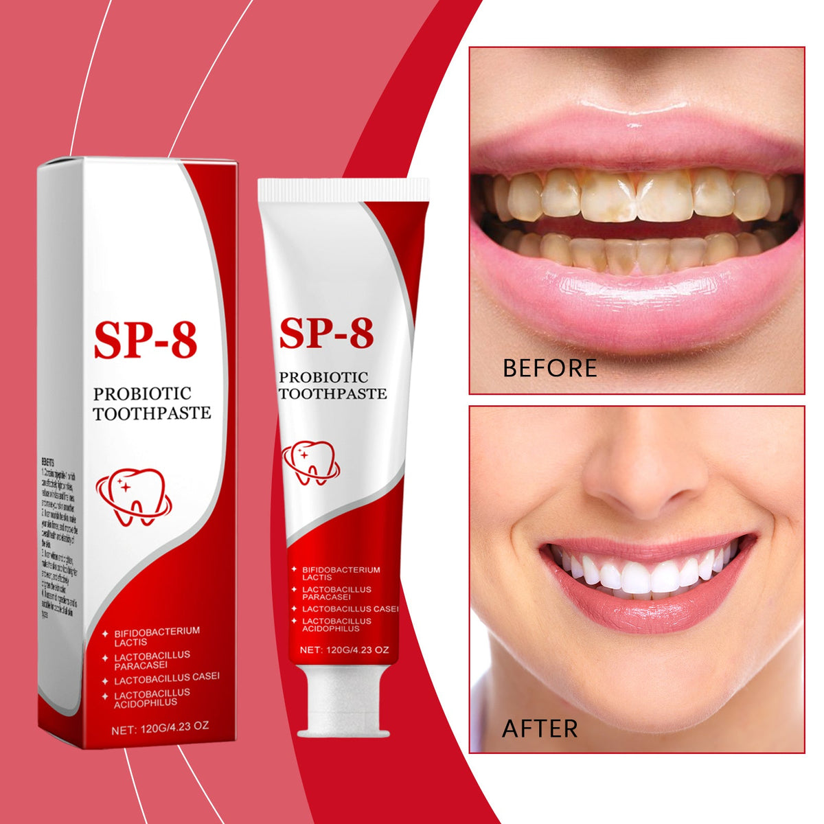 Probiotic Whitening And Stain-Removing Toothpaste 120g