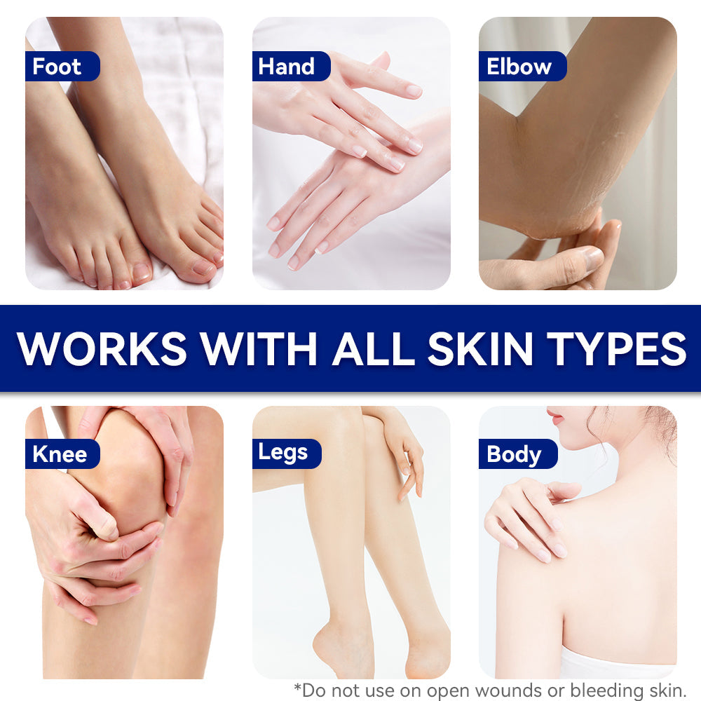 Urea cream shown for feet and hands; infographic with hand and foot application