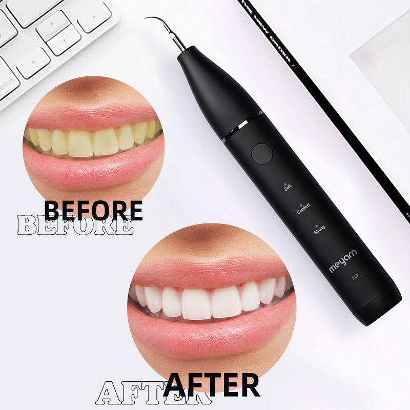 Black electric dental plaque remover shown with before and after smile area