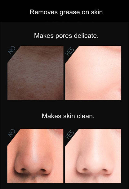 Skin close-up comparison of oil-absorbing results with before and after views