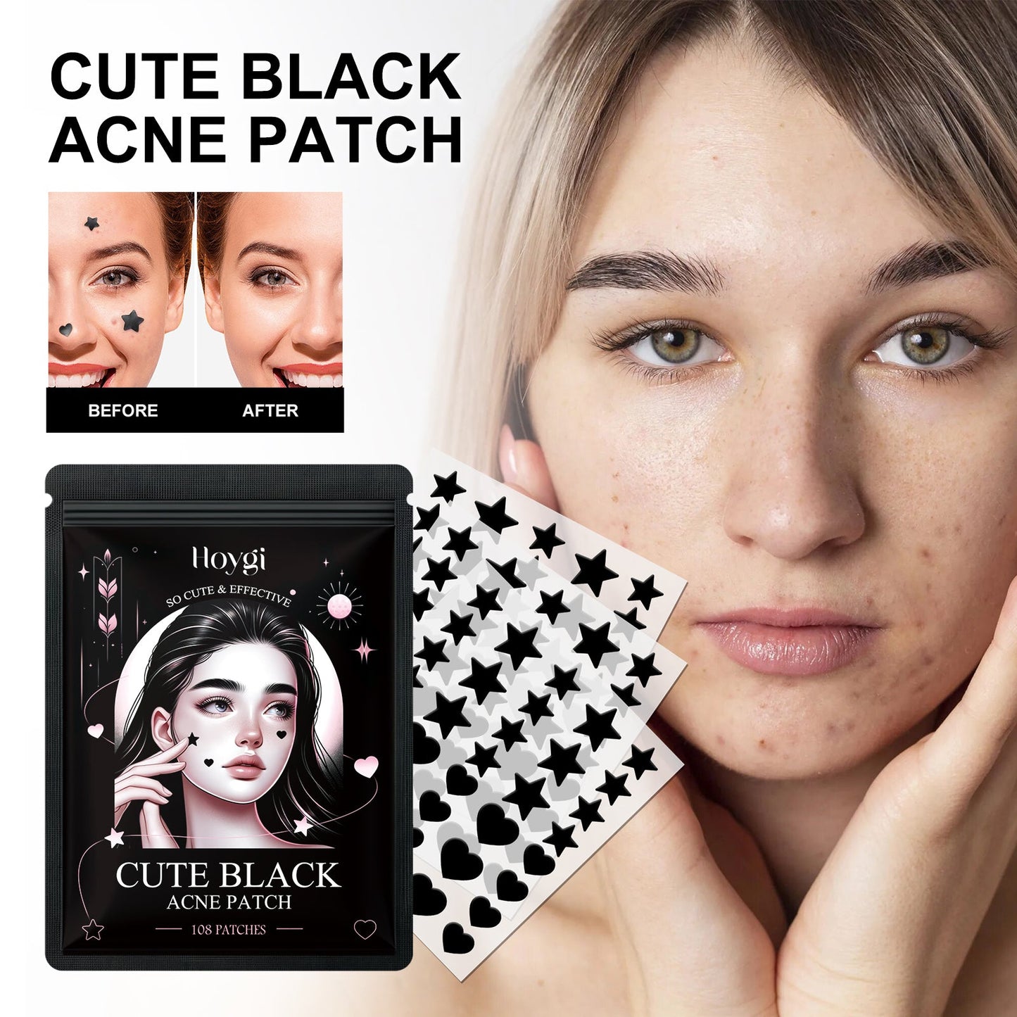 Black acne patch sheets on a woman’s cheek for acne spot coverage