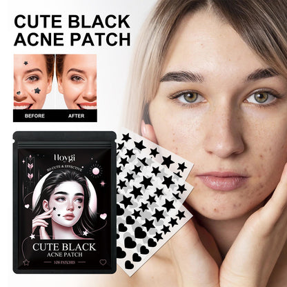 Black acne patch sheets on a woman’s cheek for acne spot coverage