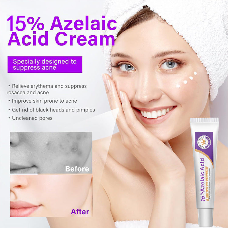 Azelaic acid serum tube displayed near a woman with skincare results