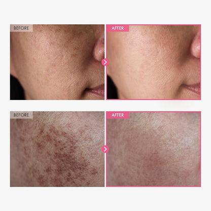 Facial Care Cream
