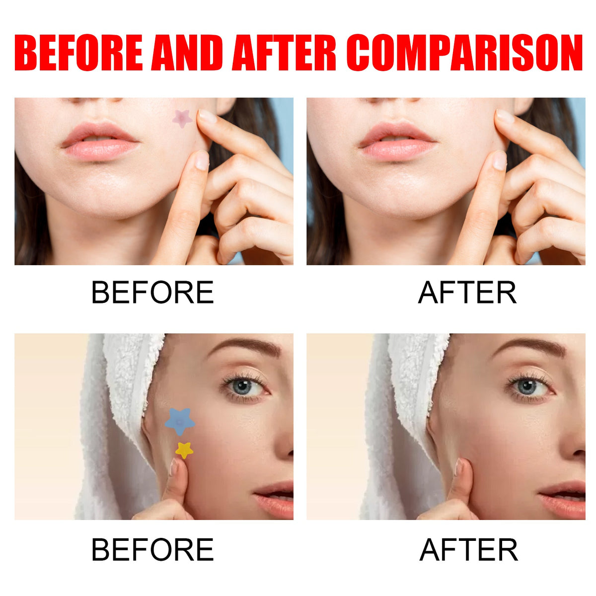 Clean Face Stickers 40 Stickers X 5 Sheets, 200pcs  1box