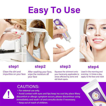 Azelaic acid serum tube held in hand, white and purple label