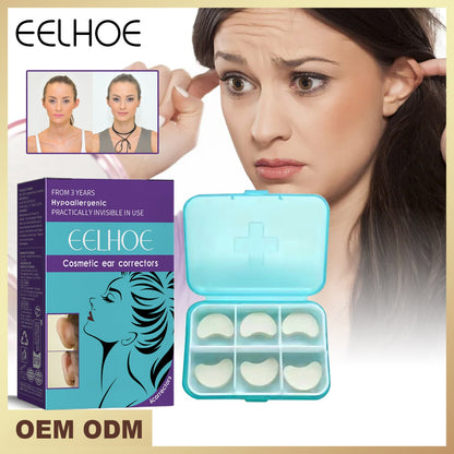 Cosmetic ear corrector stickers in open teal case with molded white adhesive pieces