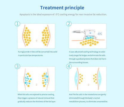 Shape Tactics Cryolipolysis Cold Vacuum Body Contouring System