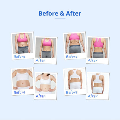 Shape Tactics 160mW Lipo Laser & Cavitation Cooling Contouring System