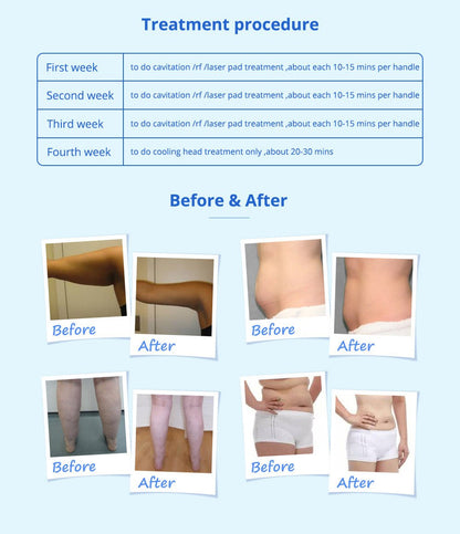 Shape Tactics 5-in-1 Cavitation Cryolipolysis Lipo Laser System