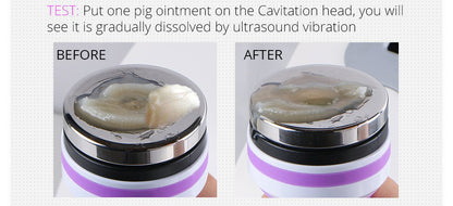 Shape Tactics 5-in-1 RF Cavitation Body Contouring System