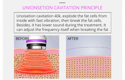 Shape Tactics 5-in-1 RF Cavitation Body Contouring System