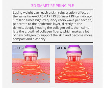 Shape Tactics 5-in-1 RF Cavitation Body Contouring System