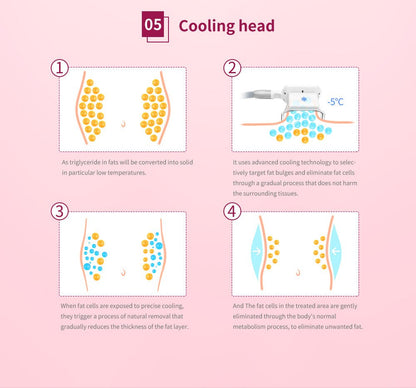 Shape Tactics 5-in-1 Cryolipolysis Vacuum RF Cooling System