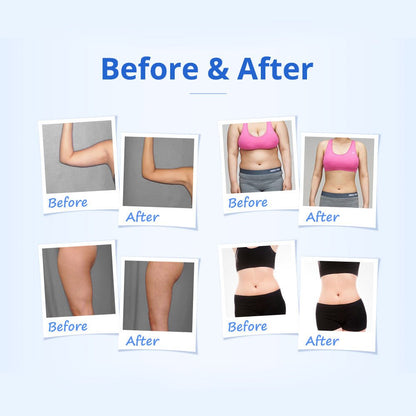 Shape Tactics 5-in-1 RF & 40K Cavitation Contouring System