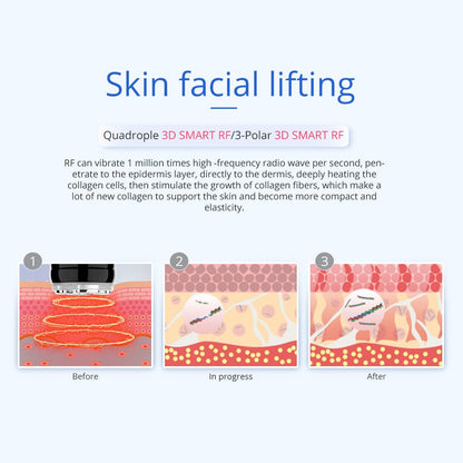 Shape Tactics 5-in-1 Unoisetion Vacuum RF System