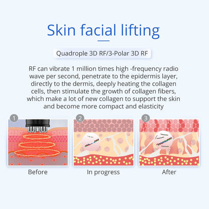 Shape Tactics 5-in-1 Unoisetion Ultrasonic RF Cavitation System