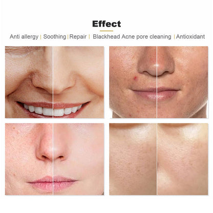 Shape Tactics Hydroge Pro Oxygen Skin Rejuvenation System