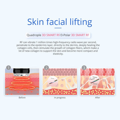 Shape Tactics 6-in-1 Unoisetion Cavitation RF 160mW System