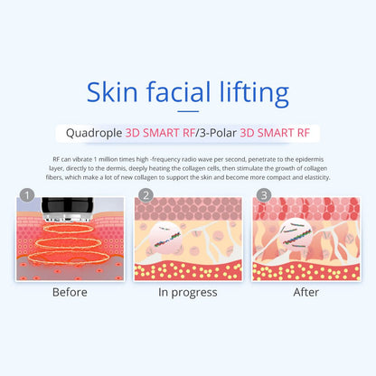 Shape Tactics 8-in-1 Microcurrent RF Cavitation & Laser Contouring System